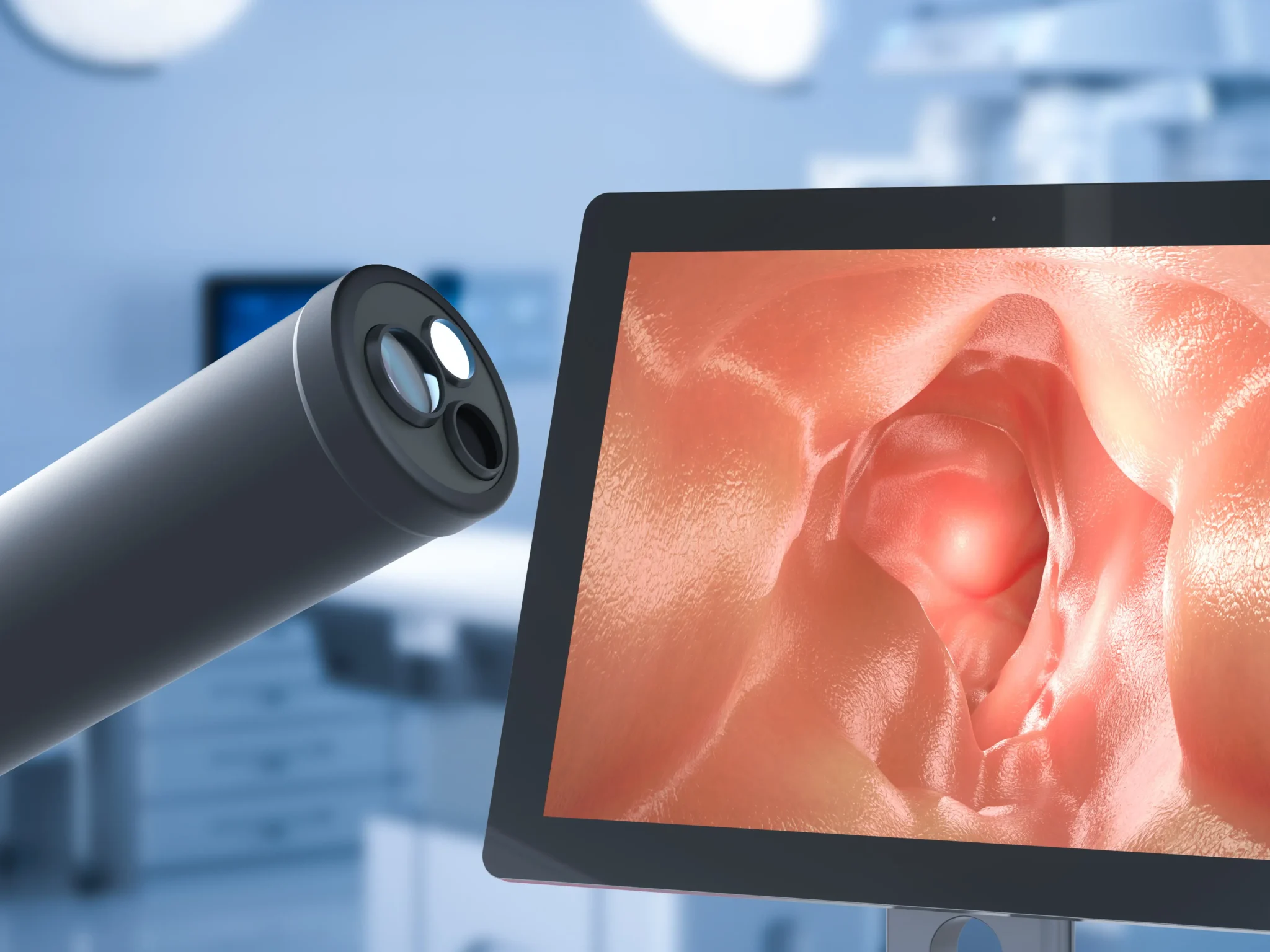 GI Endoscopy