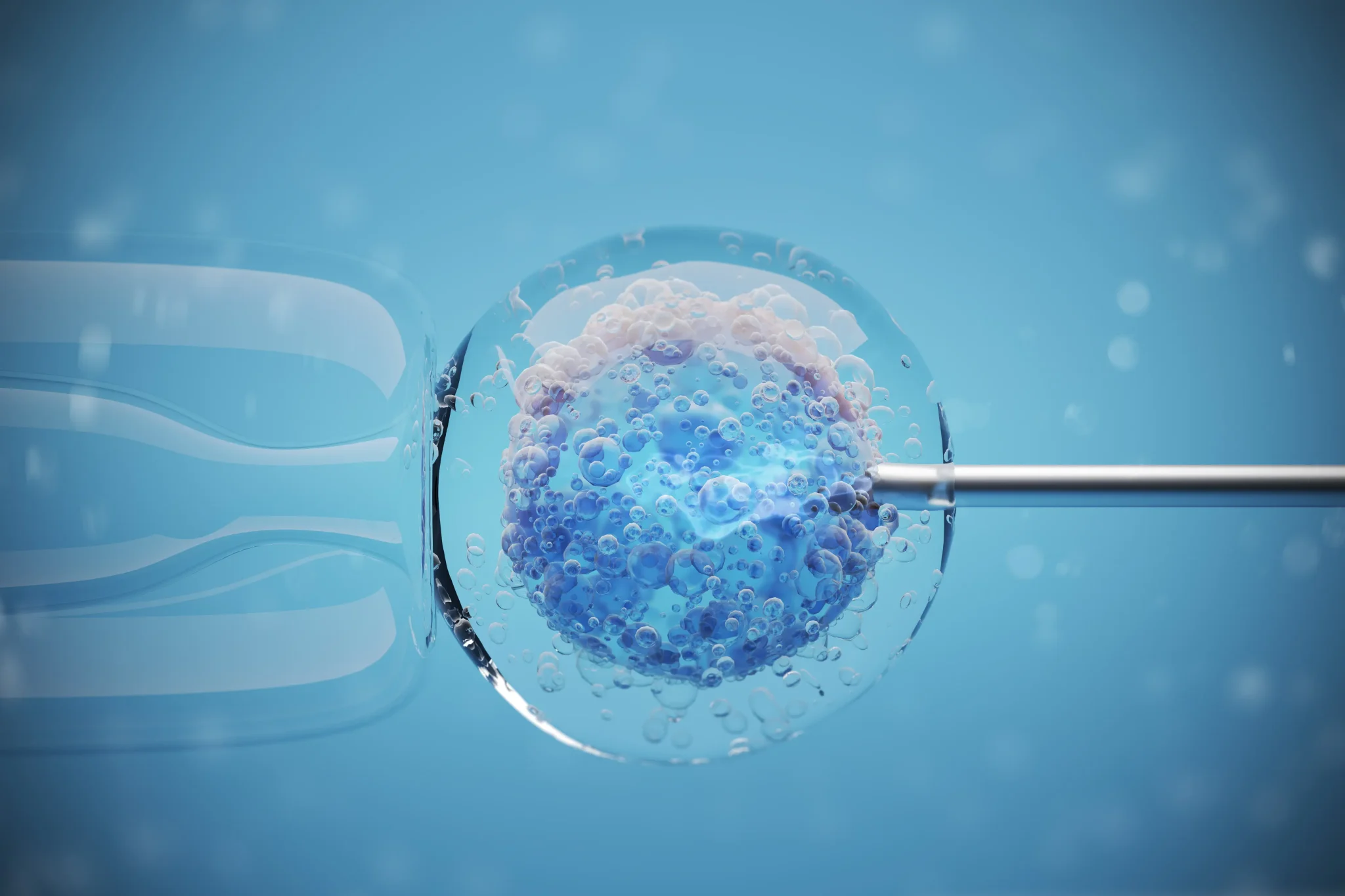 IVF (Test Tube Baby)